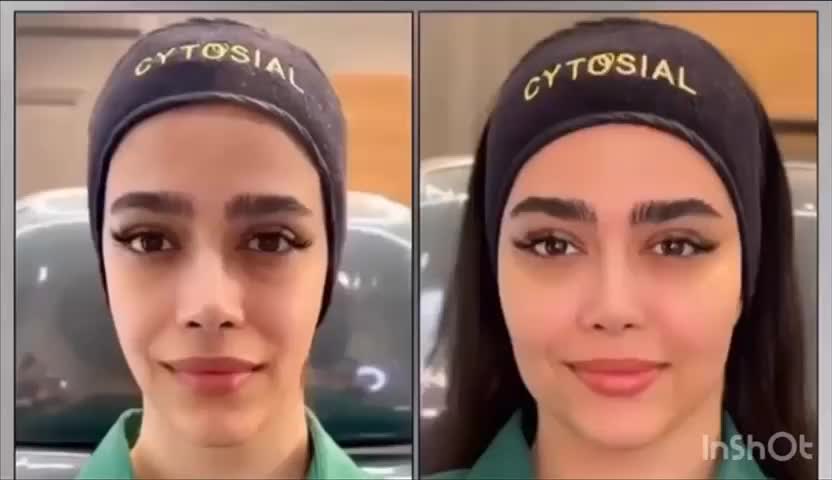 پکیج طلایی نقره ایی برنز لیفت با فیلر ژل بوتاکس|خدمات آرایشگری و زیبایی|مشهد, سناباد|دیوار