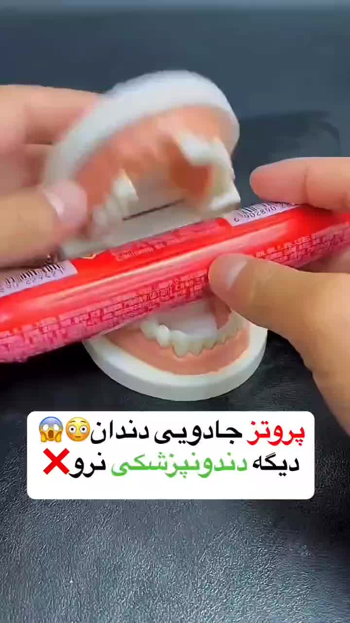 پروتز دندان جادوئی مدل south moon|آرایشی، بهداشتی، درمانی|تهران, شهرک ابوذر|دیوار