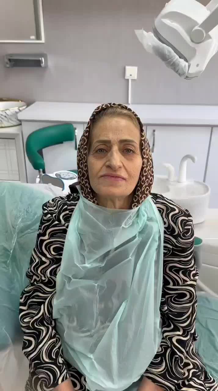 ایمپلنت اقساط بدون سود/جشنواره پاییزی به مدت محدود|خدمات آرایشگری و زیبایی|تهران, مجیدیه|دیوار