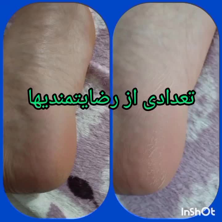 محلول نانو وگان نقره آریا|آرایشی، بهداشتی، درمانی|قم, شهدا|دیوار