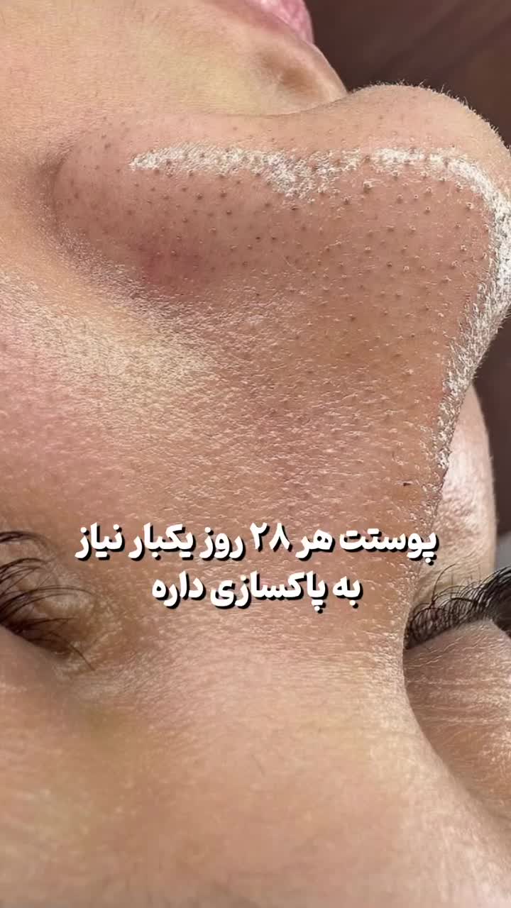 اصلاح درماپلینگ قیمت باورنکردنی|خدمات آرایشگری و زیبایی|بیرجند, |دیوار