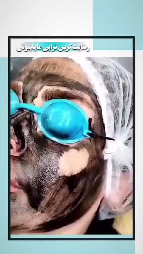 روشن کننده صورت بیکینی ،کربن تراپی تخصصی مابیوتی|خدمات آرایشگری و زیبایی|یاسوج, |دیوار