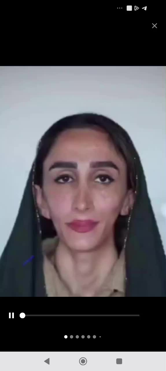 جشنواره تخفیف فیلر فول فیس ژل بوتاکس نخ هایفو|خدمات آرایشگری و زیبایی|مشهد, فرهنگ|دیوار