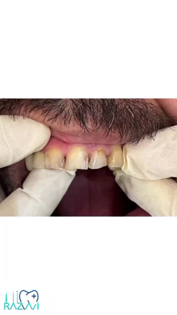 دندانپزشکی دکتر رضوی|خدمات آرایشگری و زیبایی|قم, چهار امامزاده|دیوار