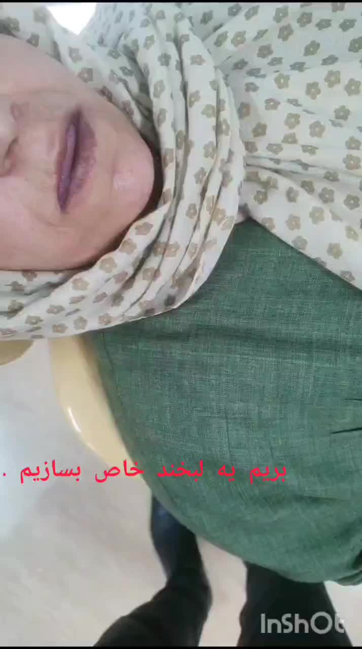 تخفیفات وشرایط اقساطی برای ایمپلنت و پروتز مصنوعی|خدمات آرایشگری و زیبایی|بجنورد, |دیوار