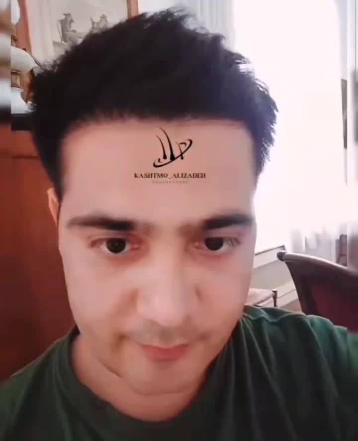 کاشت شیرازی موی سر و ابرو در ارومیه به مدت کوتاه|خدمات آرایشگری و زیبایی|ارومیه, |دیوار