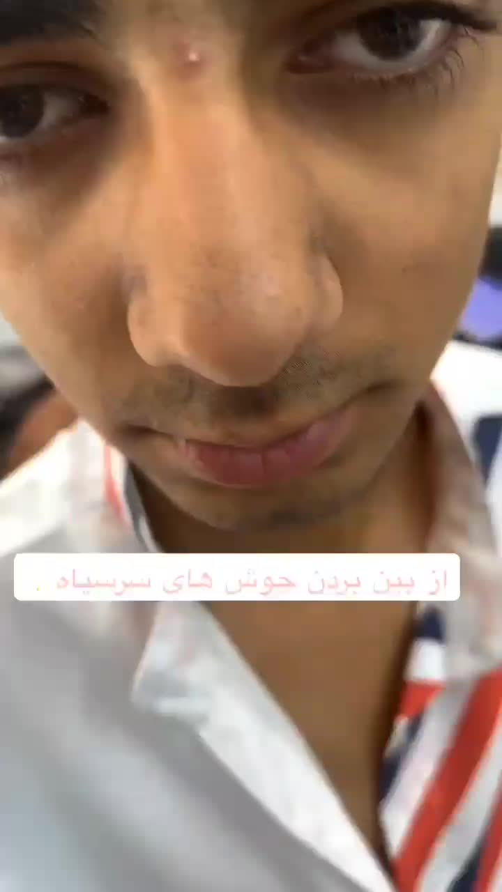 اکتیواتوفن پوست|آرایشی، بهداشتی، درمانی|سنندج, |دیوار