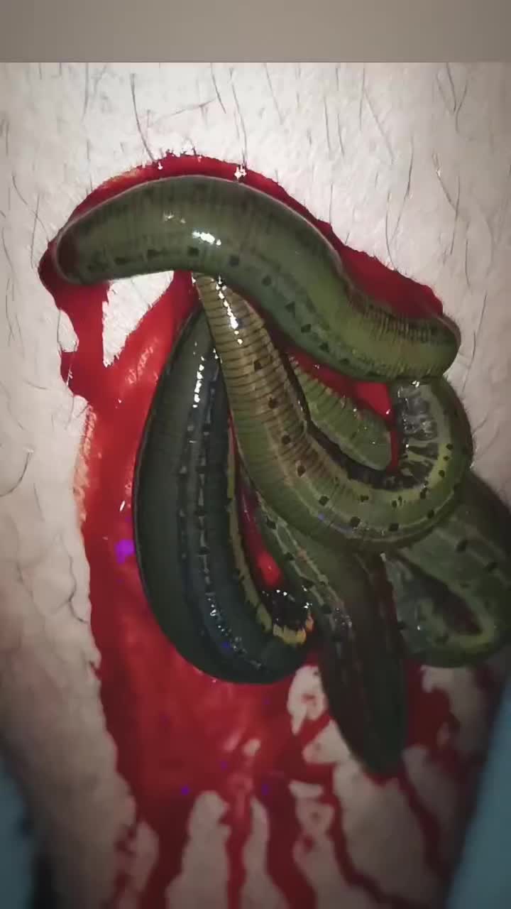 زالوی طبی  تبریز زالو|خدمات آرایشگری و زیبایی|تبریز, |دیوار