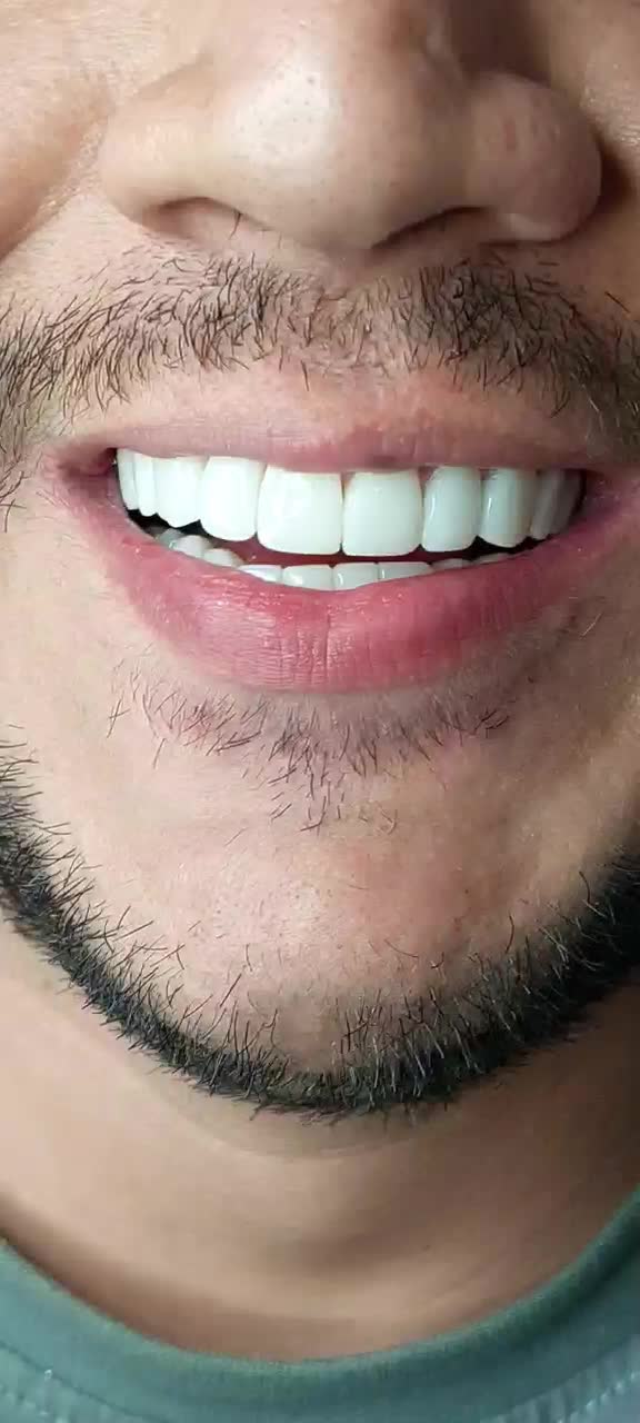 کامپوزیت زیبایی|خدمات آرایشگری و زیبایی|اسلامشهر, شهرک قائمیه|دیوار