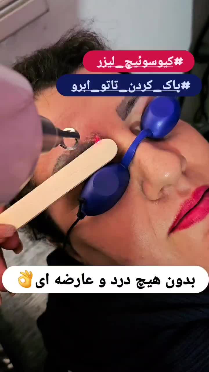 پاک کردن تتو،پیلینگ کربن،وایتینگ،ازبین بردن لک|خدمات آرایشگری و زیبایی|کرج, کمال‌شهر|دیوار