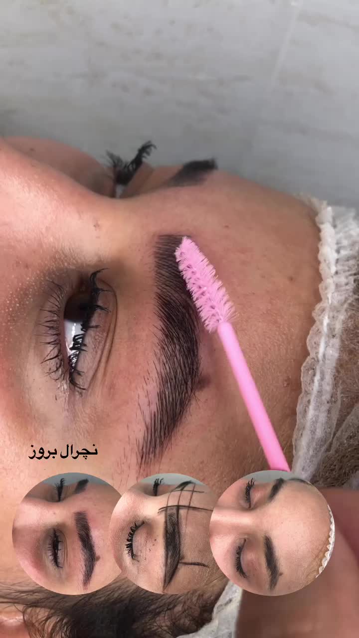 میکروبلیدینگ فیبروز شیدلب بنمژه ریموو|خدمات آرایشگری و زیبایی|شیراز, کوی زهرا|دیوار