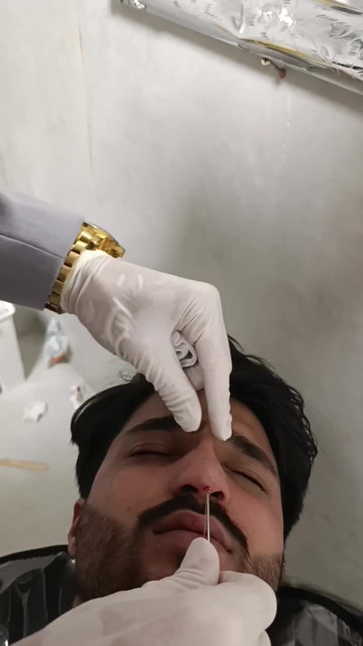 مطب‌دکترژل وبوتاکس.افزایش سایزآلت آقایان.لیفت بانخ|خدمات آرایشگری و زیبایی|قم, صفائیه|دیوار