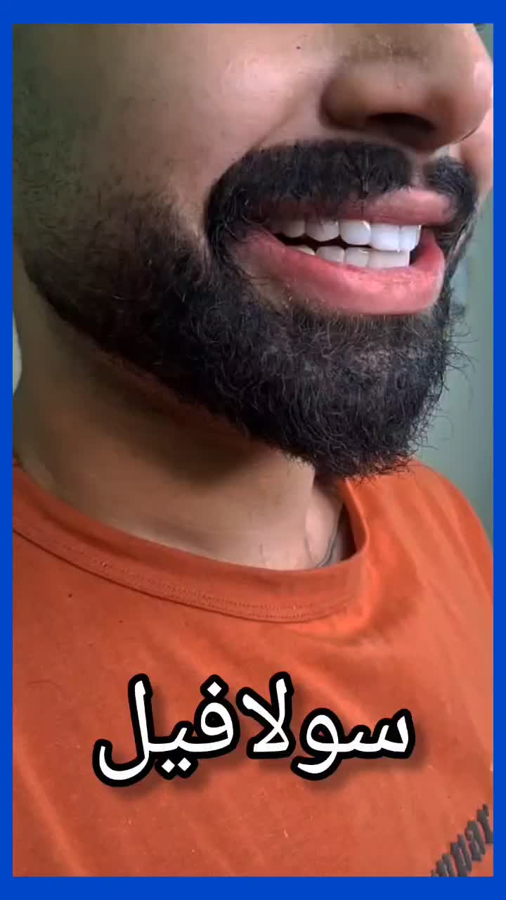 کامپوزیت/دندانپزشکی/عصبکشی/لیرینگ/ترمیم پالیش|خدمات زیبایی و سلامت|تهران, تهرانپارس شرقی|دیوار