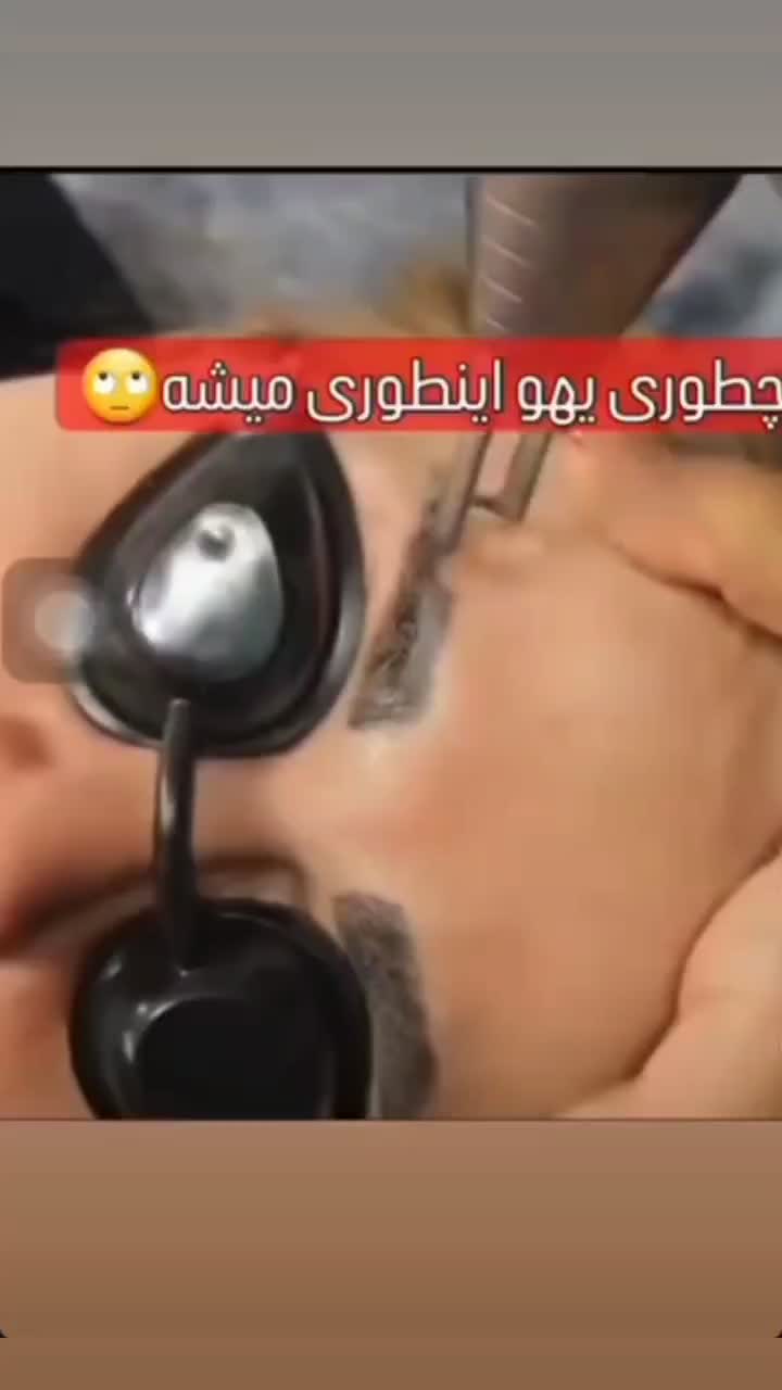 رفع تیرگی بدن  و لیزر تتوهای قدیمی بدن و صورت|خدمات آرایشگری و زیبایی|یاسوج, |دیوار