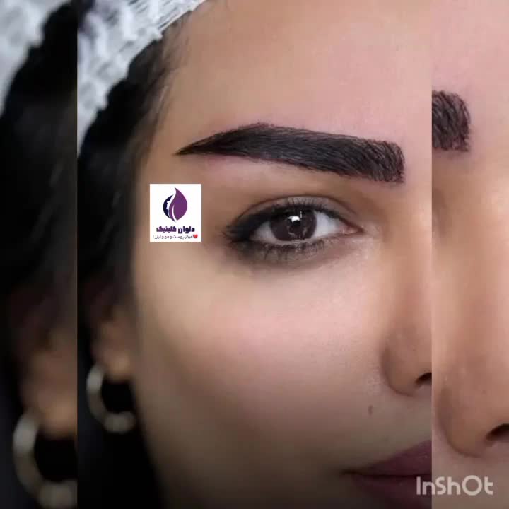 تخفیف پاییز تا یلدا کاشت مو و ابرو و مژه|خدمات آرایشگری و زیبایی|زاهدان, |دیوار