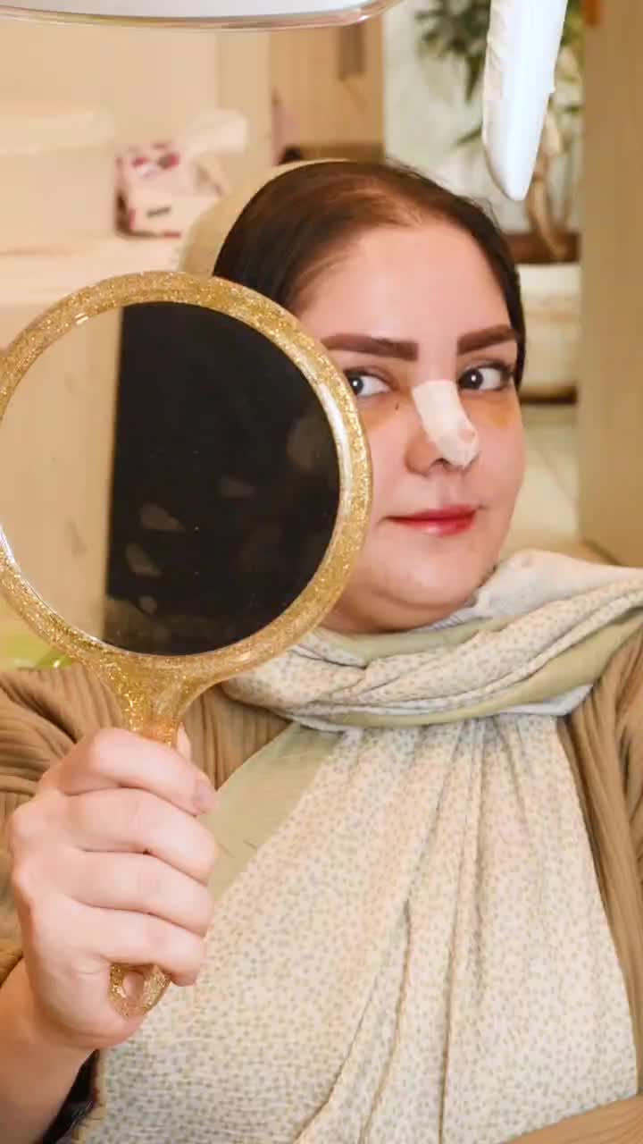 جراحی بینی اقساطی (با ۱۸ تومن پیش پرداخت )|خدمات آرایشگری و زیبایی|رشت, گلباغ نماز|دیوار