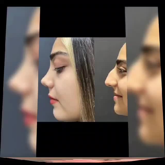 جراحی زیبایی بینی در پایتخت جراحی بینی ایران|خدمات آرایشگری و زیبایی|مشهد, عنصری|دیوار