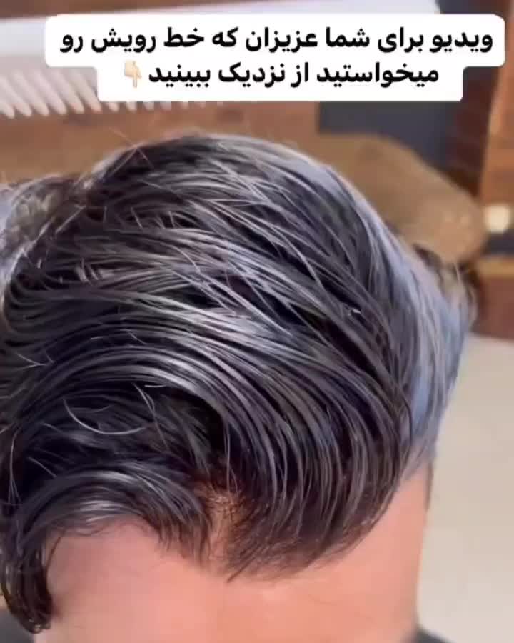 پروتز مو وارداتی ،کاشت hrt|خدمات آرایشگری و زیبایی|اصفهان, گلزار|دیوار