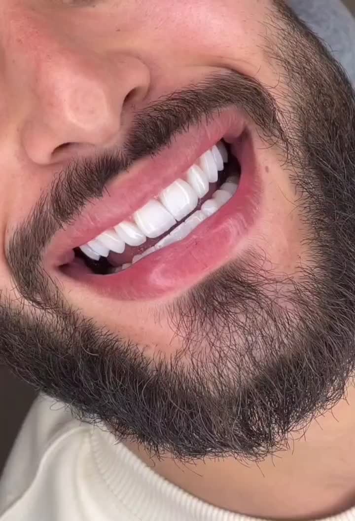 دندانپزشکی/کامپوزیت دندان/ترمیم/روکش/عصبکشی|خدمات آرایشگری و زیبایی|تهران, تهرانپارس شرقی|دیوار