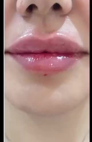 جشنواره مرکز تزریق چربی صورت ،ژل ،بوتاکس.prp|خدمات آرایشگری و زیبایی|کرج, اصفهانی‌ها|دیوار