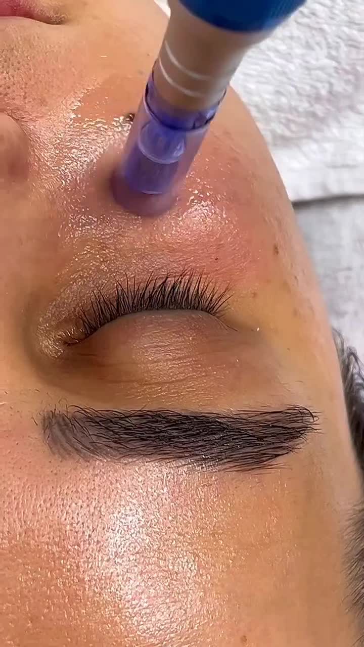 آموزش رایگان میکرونیدلینگ و مزونیدلینگ|خدمات آموزشی|اهواز, نادری|دیوار