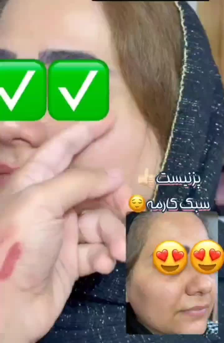 درمان جوش با بهترین روش و محصول|آرایشی، بهداشتی، درمانی|اهواز, ۲۰۰۰واحدی|دیوار