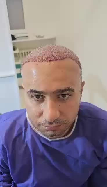 جشنواره کاشت تخصصی موفقط 8/900با ضمانت|خدمات آرایشگری و زیبایی|تهران, پاسداران|دیوار