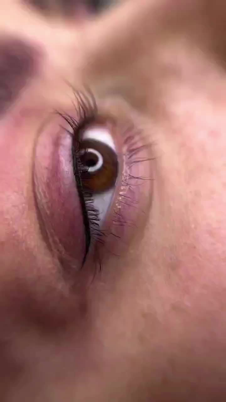 تخفیف ویژه میکرووژل بوتاکس|خدمات آرایشگری و زیبایی|بیرجند, |دیوار