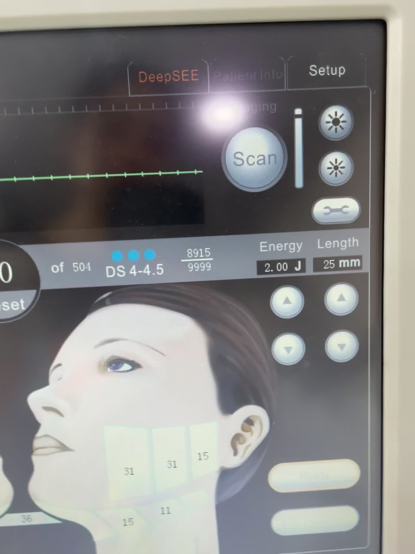 هایفو اولترا کره ای ۵بعدی|آرایشی، بهداشتی، درمانی|بم, |دیوار