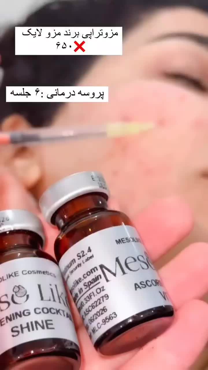 تزریق فیلر وبوتاکس وجوانساز صورت|خدمات آرایشگری و زیبایی|کارون, |دیوار