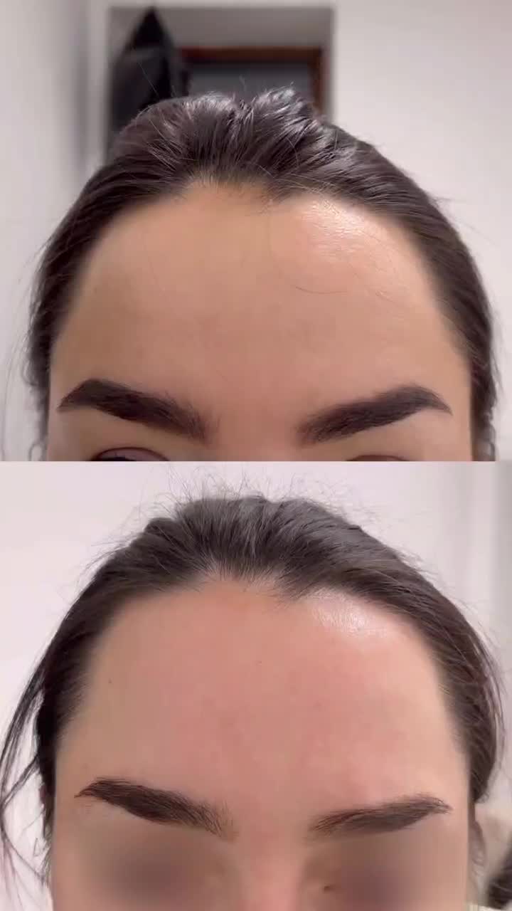 تخفیفات فیلر بادی ،بوتاکس،کانتورینگ توسط پزشک|خدمات آرایشگری و زیبایی|کرج, گوهردشت|دیوار