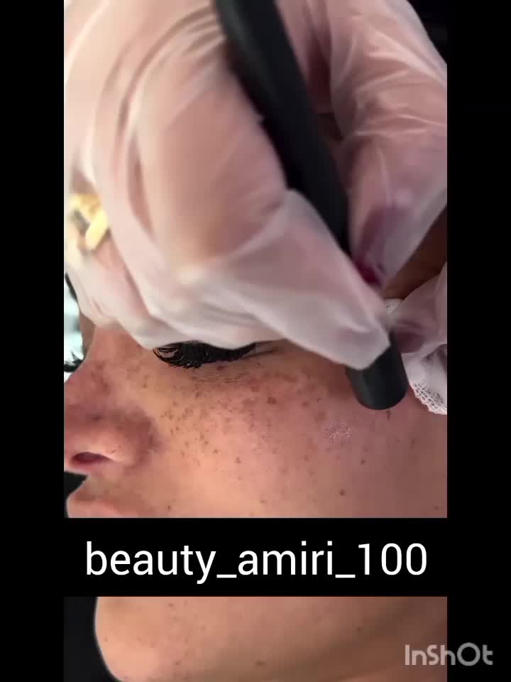 خدمات حرفه ای تخصصی،لک کک مک موی زائدسفیدالکترولیز|خدمات آرایشگری و زیبایی|قم, صفائیه|دیوار