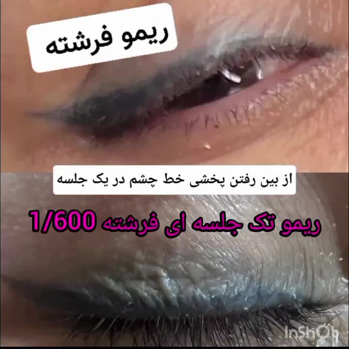 ریمو تتو قدیمی زیرسازی واصلاح میکروکاورینگ|خدمات آرایشگری و زیبایی|اصفهان, خواجه عمید|دیوار