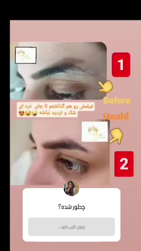 پاک کردن یا ریموو تک جلسه ای صورت و بدن|خدمات آرایشگری و زیبایی|آبدانان, |دیوار