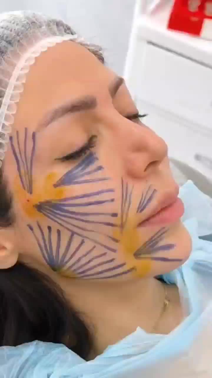 ژل و بوتاکس|خدمات آرایشگری و زیبایی|جیرفت, |دیوار