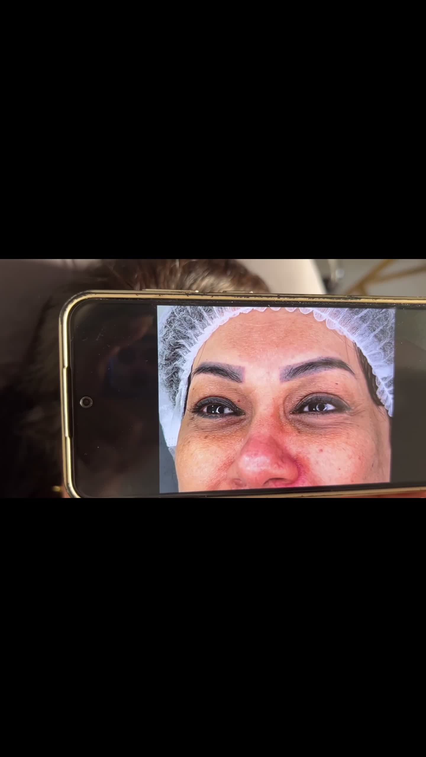 ریموو تاتو های صورت ابرو و چشم و لب در یک جلسه|خدمات آرایشگری و زیبایی|دزفول, |دیوار