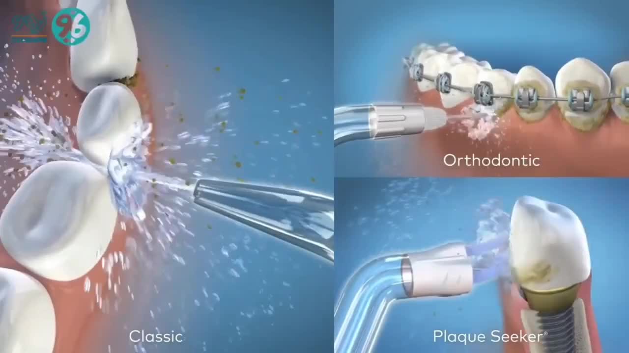 واترجت دندان شارژی ارتودنسی کامپوزیت ایمپلنت|آرایشی، بهداشتی، درمانی|تبریز, |دیوار