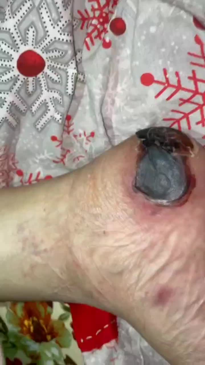 درمانگر زخم|خدمات آرایشگری و زیبایی|سیرجان, |دیوار