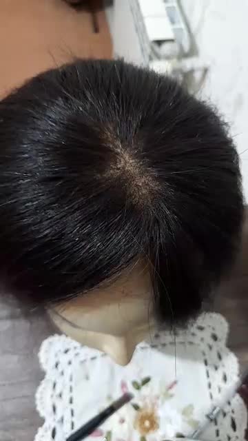 موطبیعی پروتز کف سر|آرایشی، بهداشتی، درمانی|پرند, فاز ۶|دیوار