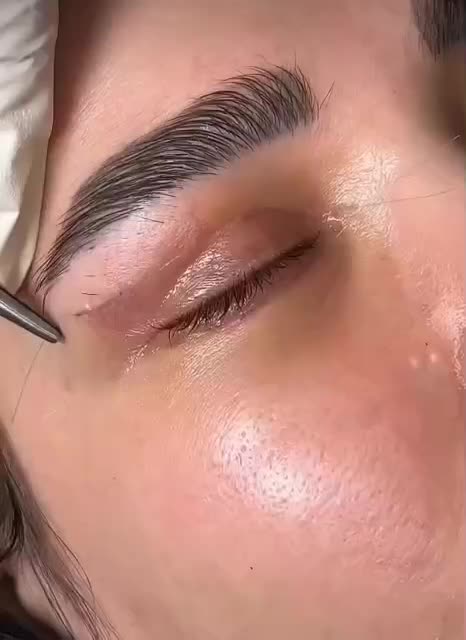 آفر ویژه عمل بینی /پلک /دندان/لیپوساکشن/غبغب|خدمات آرایشگری و زیبایی|شیراز, عفیف‌آباد|دیوار