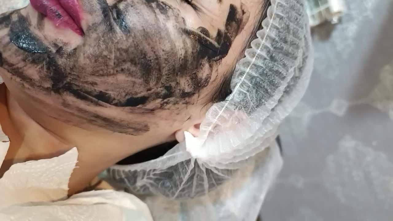 لیزر تضمینی موهای زائد رفع لک روشن کننده|خدمات آرایشگری و زیبایی|رشت, کاکتوس|دیوار