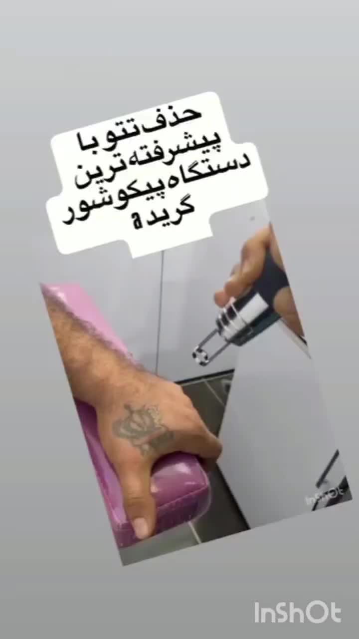 پاک کردن تتو ابرو و بدن با دستگاه لیزر پیکوشور|خدمات آرایشگری و زیبایی|ارومیه, |دیوار
