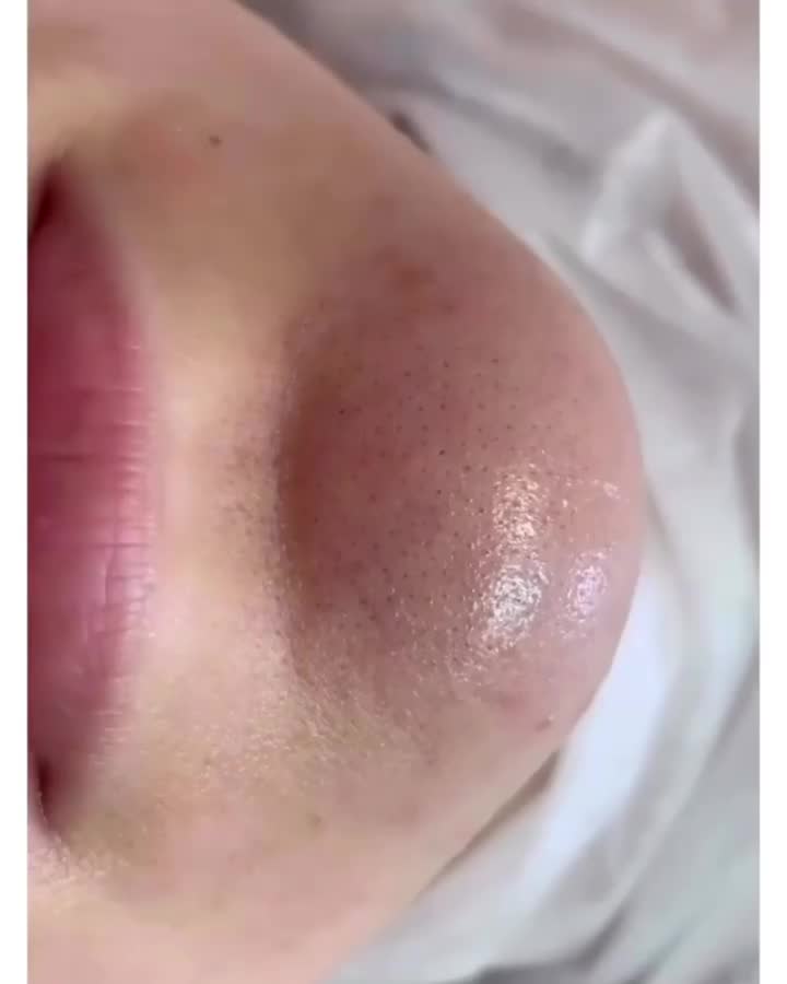 فیشال تخصصی و حرفه ای 50% تخفیف به مدت محدود|خدمات آرایشگری و زیبایی|شیراز, رحمتآباد|دیوار