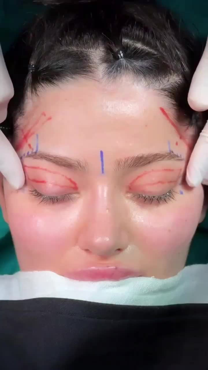 جراحی با جراحان با سابقه زیبایی+ کاشت مو|خدمات زیبایی و سلامت|تهران, آسمان|دیوار