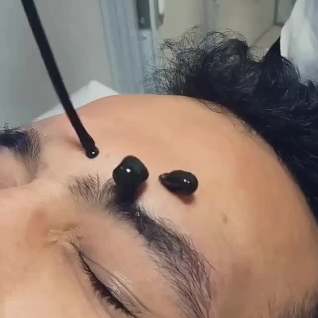 طب سنتی سیاتیک کمر درد دیسک بادکش حجامت زالو فصد|خدمات آرایشگری و زیبایی|ملارد, |دیوار