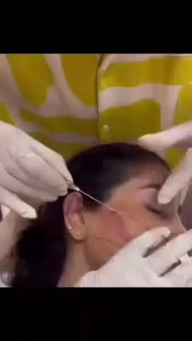 آموزش فیلر ژل بوتاکس نخ لیفت لیزر مو فشیال حجامت|خدمات آموزشی|اصفهان, هزارجریب|دیوار