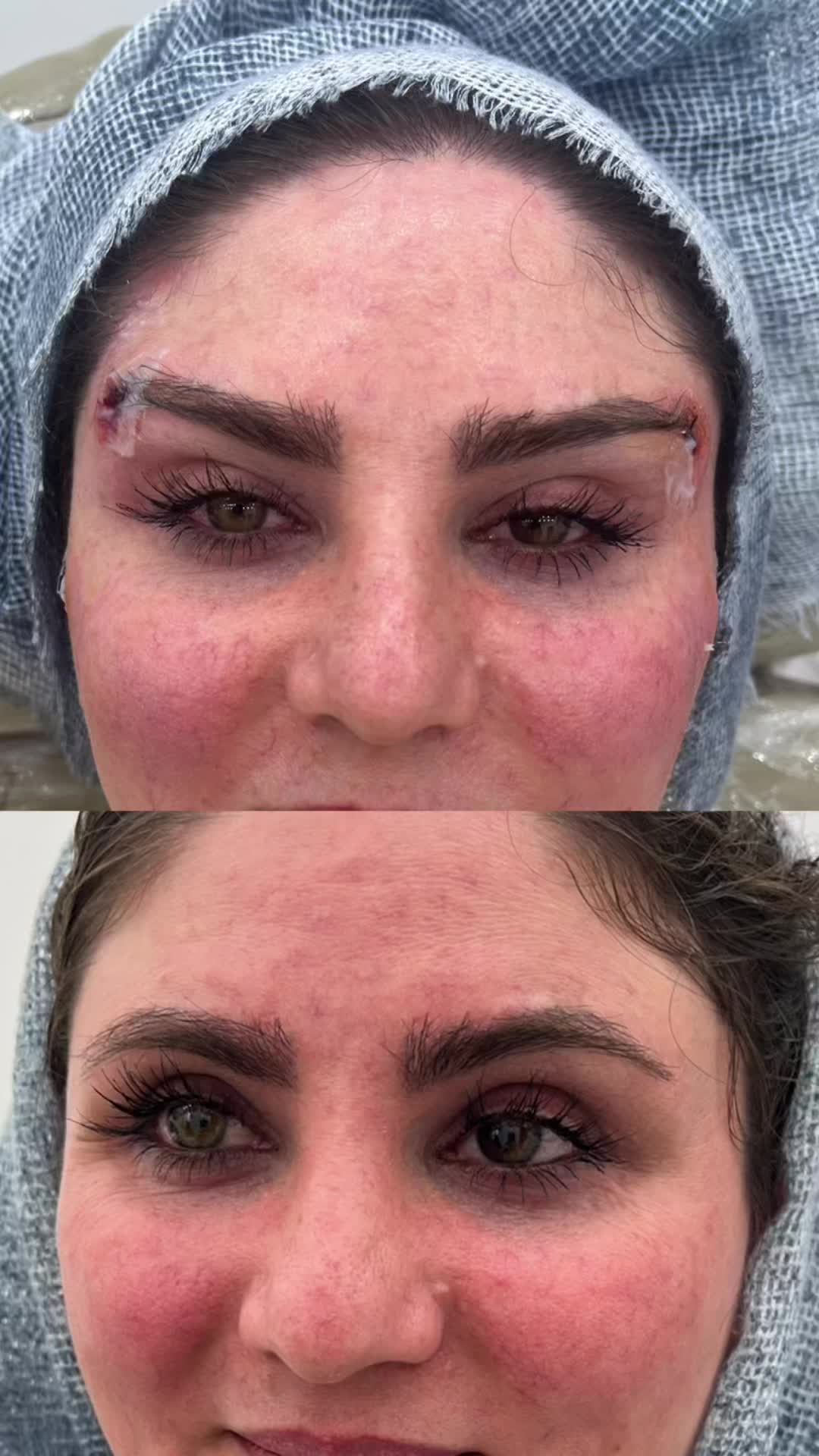 تخفیفات جمعه سیاه با بوتاکس رایگان توسط پزشک|خدمات آرایشگری و زیبایی|قم, هفت تیر|دیوار