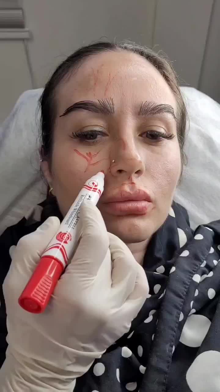 آموزشب وتاکس ژل فیلر نخ لیفت لیزر مو طب سنتی فشیال|خدمات آموزشی|اصفهان, جلفا|دیوار