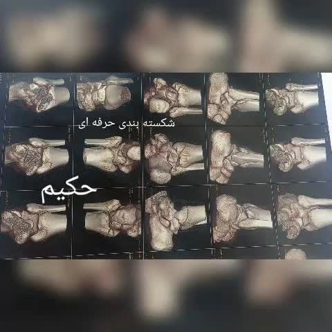 مرکز طب سنتی و شکسته‌بندی حکیم|خدمات آرایشگری و زیبایی|تهران, هفده شهریور|دیوار
