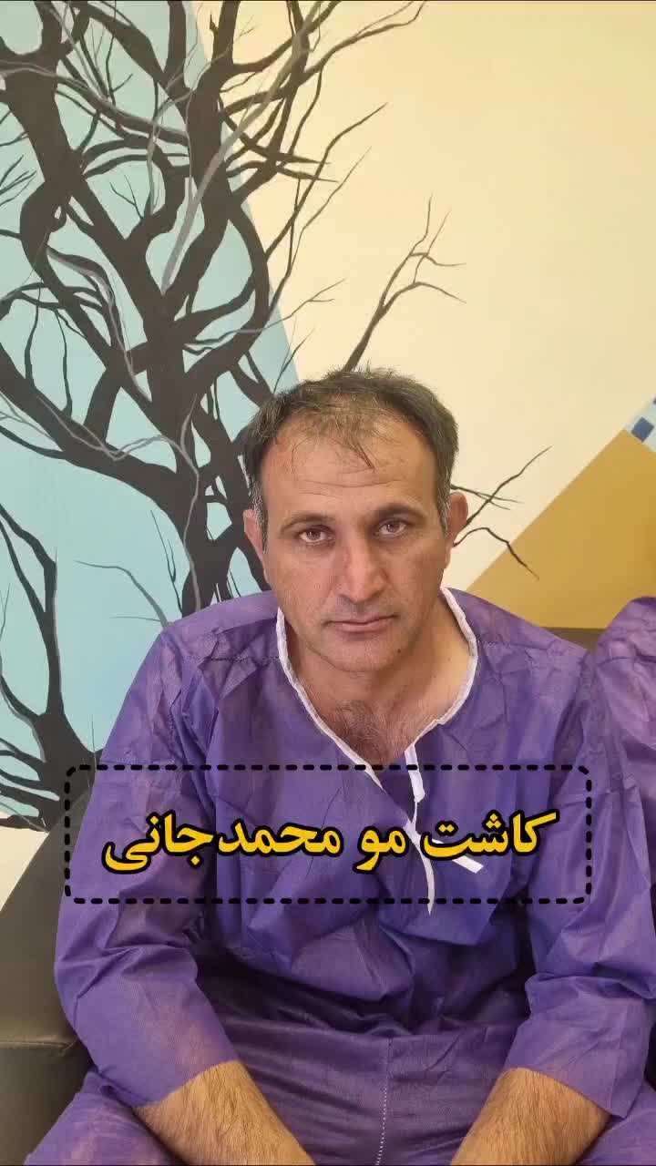 کاشت مو ،ابرو و ریش در شیراز|خدمات آرایشگری و زیبایی|کازرون, |دیوار